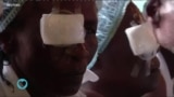 Saúde em Foco: o que é o Glaucoma e como a perda de visão afeta as pessoas no mundo inteiro?