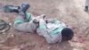 One of the workers allegedly brutalized by Chinese employers in Zimbabwe