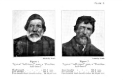 Illustration from a 1916 book, Indian-white Amalgamation: an Anthropometric Study by Albert Ernest Jenks, a study used to force "mixed bloods" to sell land previously alloted to them on the White Earth Reservation in Minnesota.