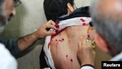 Medics help an injured man after mortars land on the canteen of Damascus University's College of Architecture, March 28, 2013.