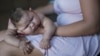 Những điều cần biết về virus Zika