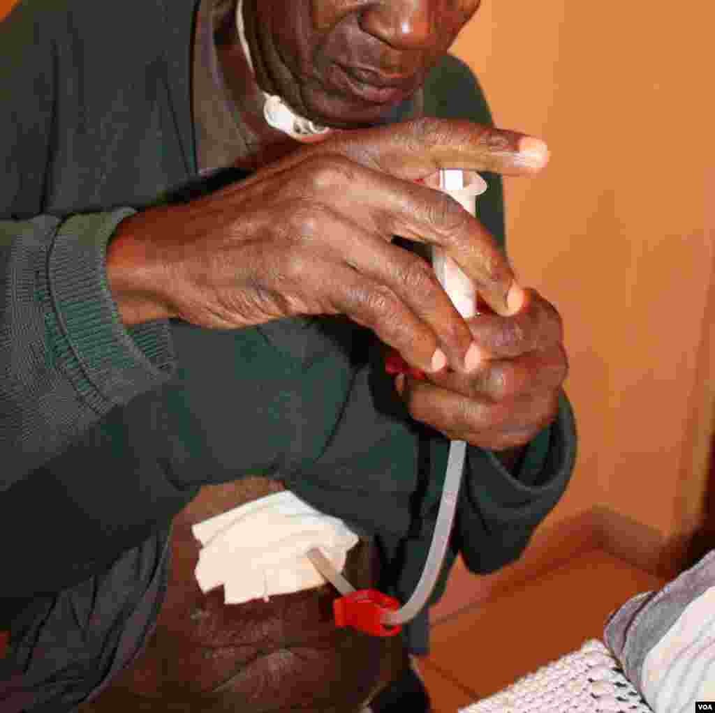 Motlabane feeds himself through a white pipe below his chin that enters a hole in his stomach. The pipe also helps him to breathe and to talk through a hole in his throat. (Photo by Darren Taylor) 