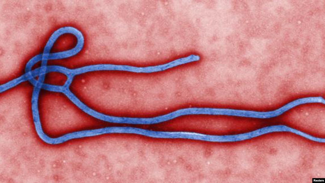Kwayar Cutar Ebola (bayan da aka yi amfani da gilashin da ya kara girmanta yadda idon dan Adam zai iya gani)