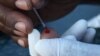 Blood is taken from someone’s finger to test it for HIV at Bulungula, South Africa (D. Taylor/VOA)
