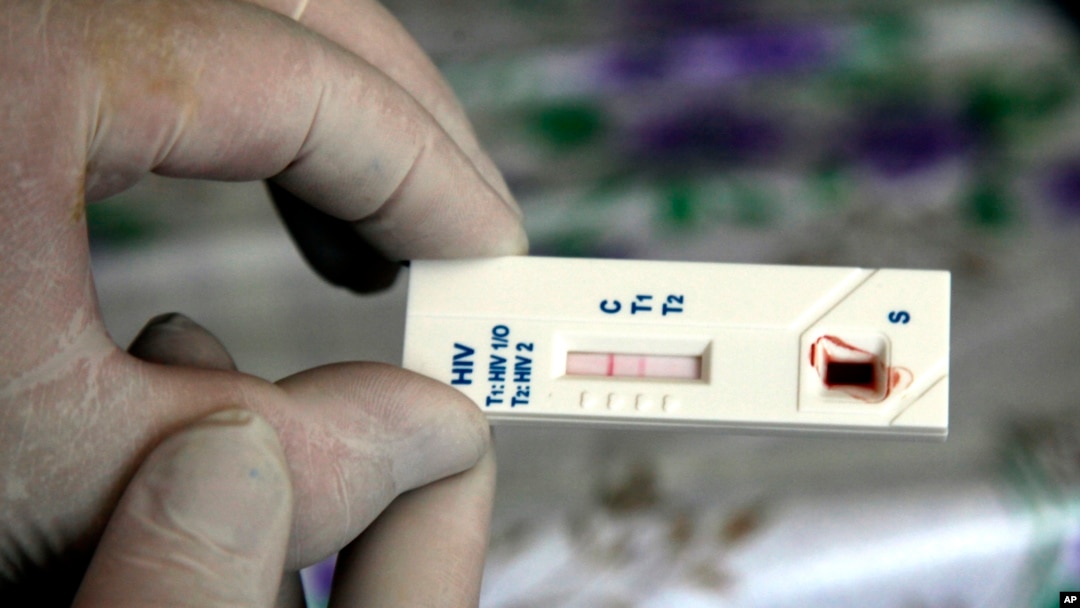 FILE - An HIV/AIDS rapid blood test shows the two red strips of a positive result in an improvised mini-lab, Kyiv, Ukraine.