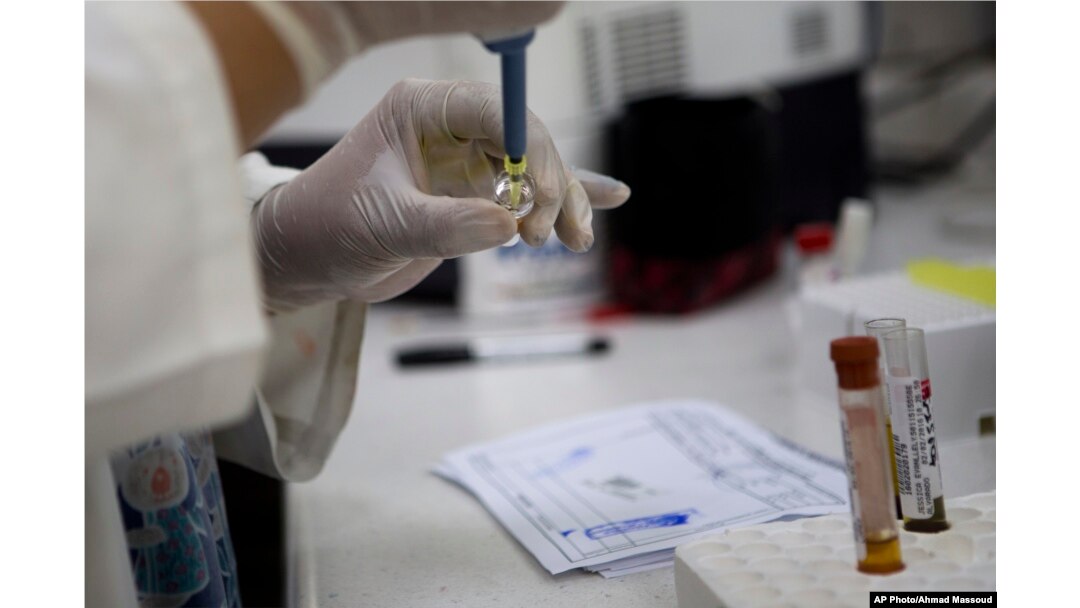 FILE - Blood samples from pregnant women are analyzed for the presence of the Zika virus, at Guatemalan Social Security maternity hospital in Guatemala City, Feb. 2, 2016.