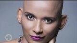 Saúde em Foco: "Quando a gente tem cancro não há manual de instruções", Sónia Sultuane