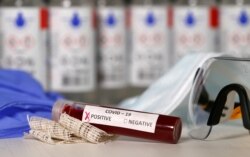 Testiranje krvi na koronavirus (ilustracija)