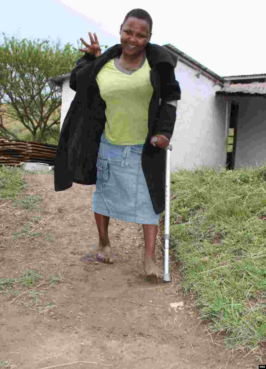 Lumka must walk with the aid of a crutch, but she often falls and hurts herself (VOA/ D. Taylor)