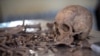 Human remains recovered from a mass grave in Somaliland are arranged for analysis by forensic investigators. (J. Patinkin/VOA)