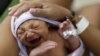 Khuyến cáo mới về virus Zika