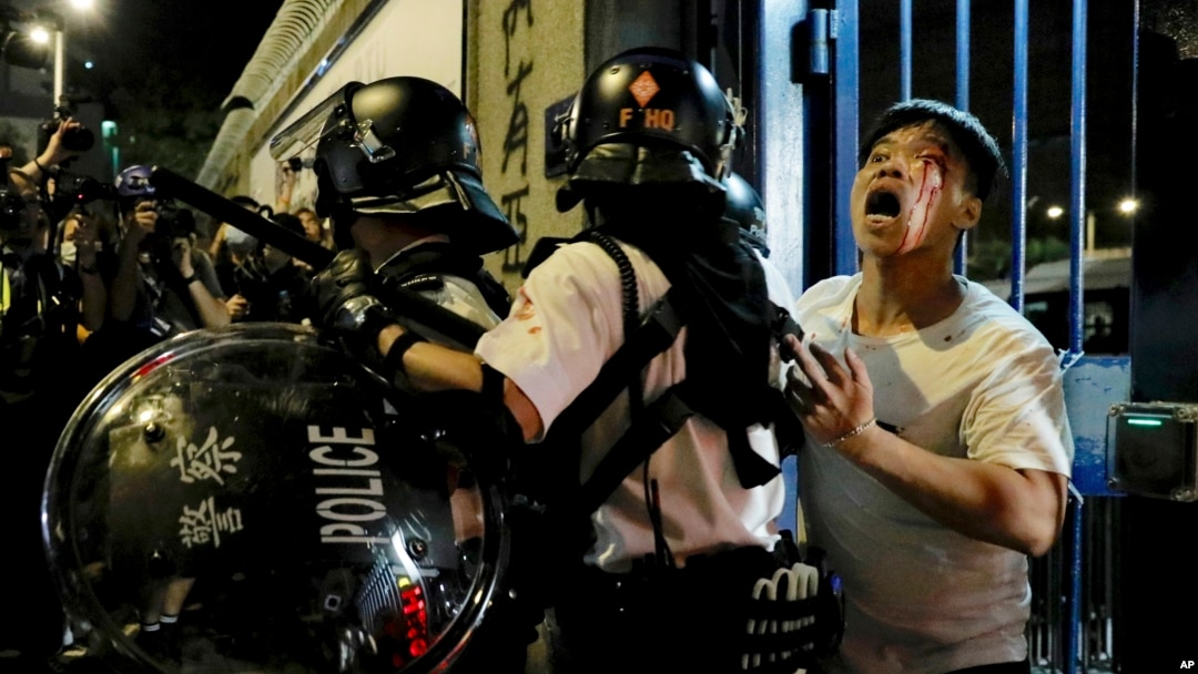 A bleeding man is taken away by policemen after attacked by protesters outside Kwai Chung police station in Hong Kong, Wednesday, July 31, 2019.