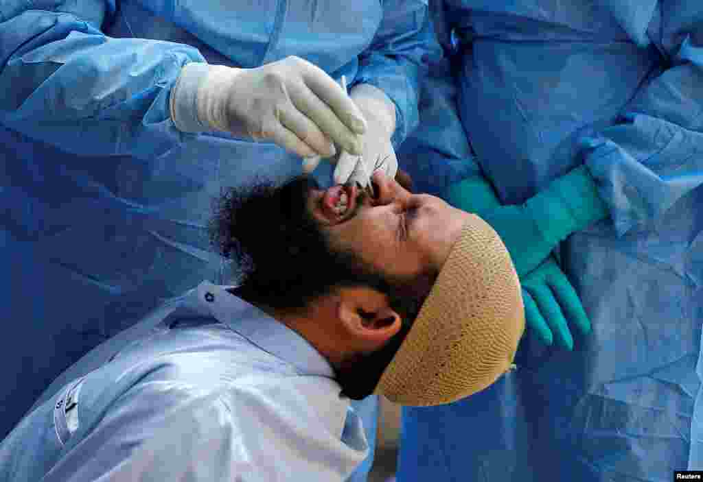 A man reacts as a doctor wearing a protective gear takes a swab from him to test for the coronavirus disease (COVID-19) at a residential area in Ahmedabad, India.