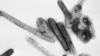 This negative stained transmission electron micrograph (TEM) depicts a number of filamentous Marburg virions. Authorities in West Africa have confirmed the region's first known case of Marburg virus after at least one person in Guinea died of the disease.