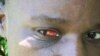 A farm worker in Zimbabwe with injuries to her face and eyes after she was beaten, allegedly by Zanu-PF supporters