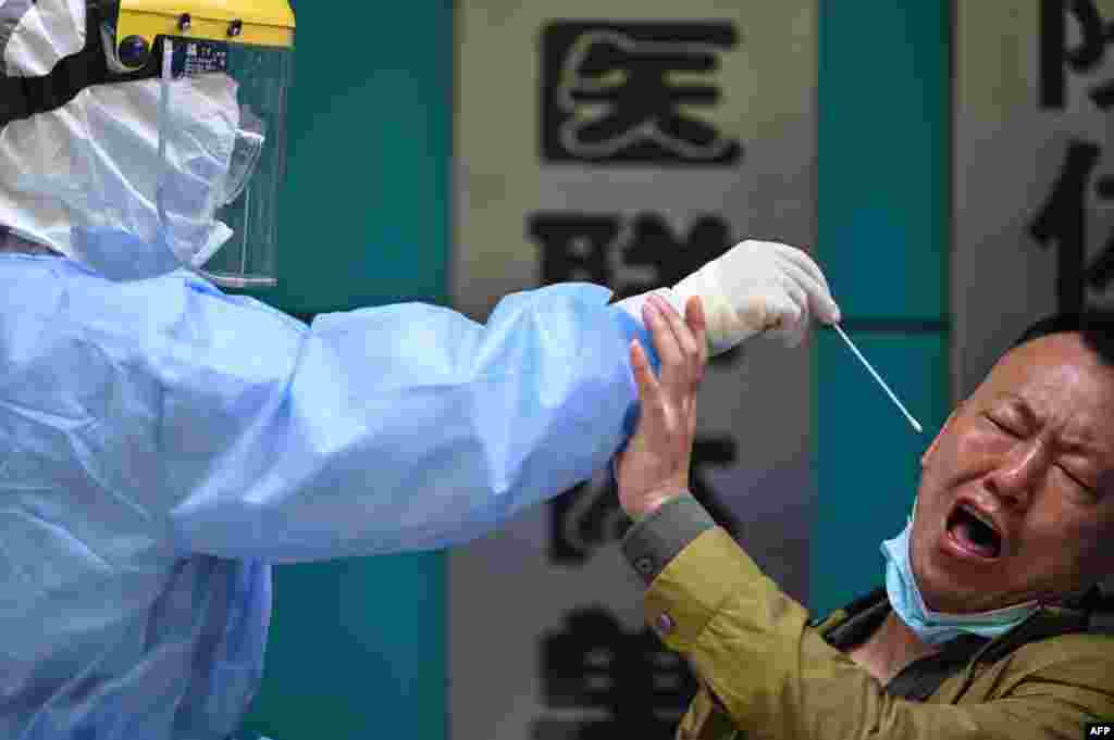 A man reacts as a medical worker takes a swab sample in Wuhan in China's central Hubei province.